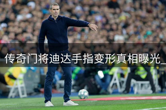 传奇门将迪达手指变形真相曝光 30年职业生涯铸就特殊勋章